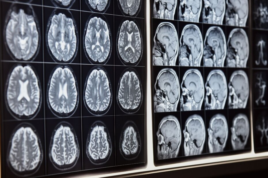 medical-therapy-using-sound-wave-frequencies-destroy-cancer