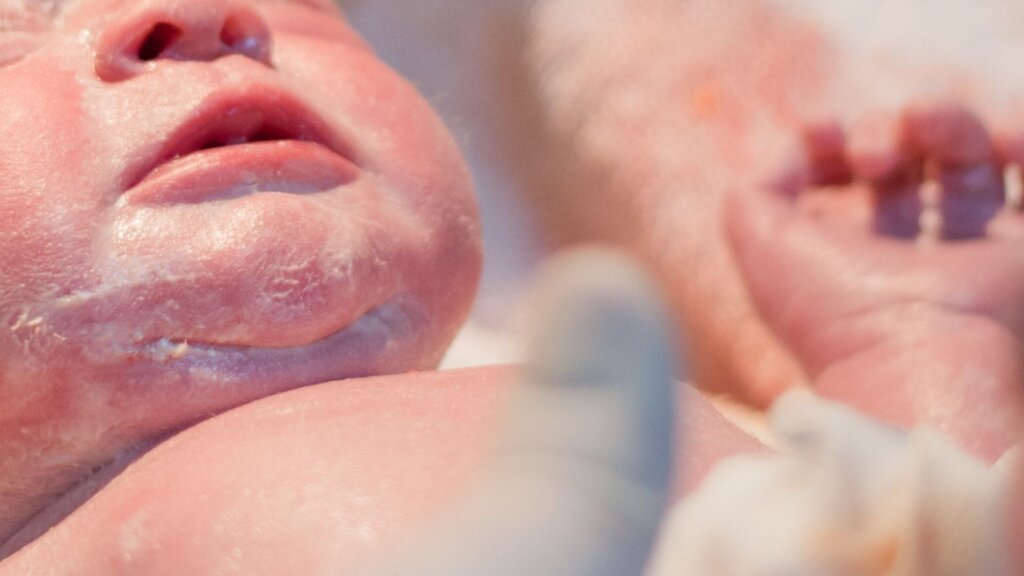 white-stuff-newborn-baby-skin-vernix-caseosa